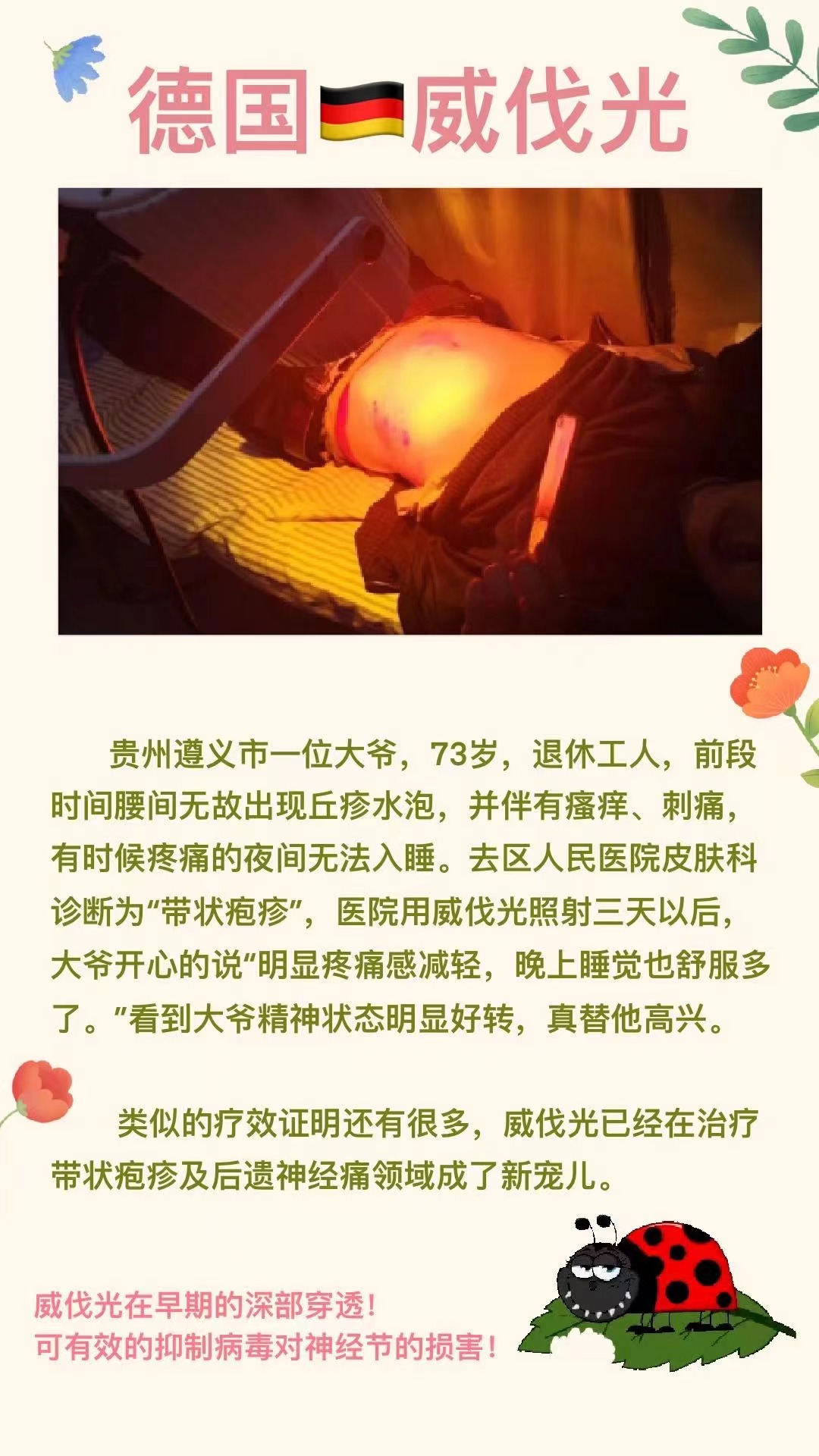 德国威伐光——带状疱疹（2022.11.02）