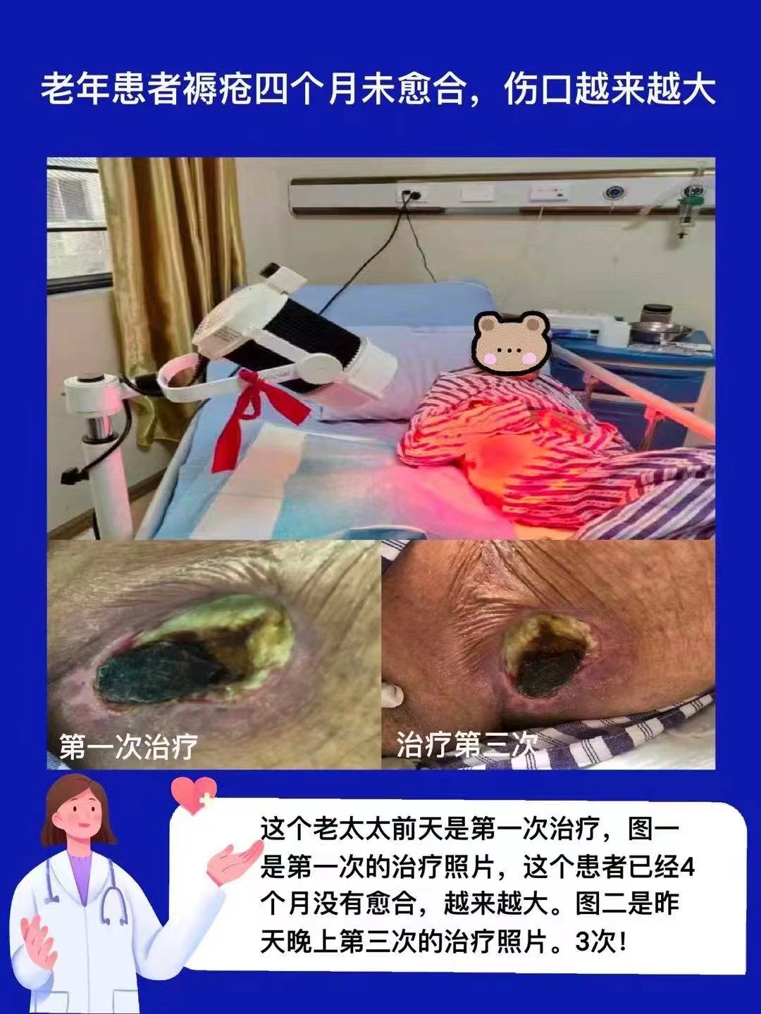 老年患者褥疮愈合治疗（230529）